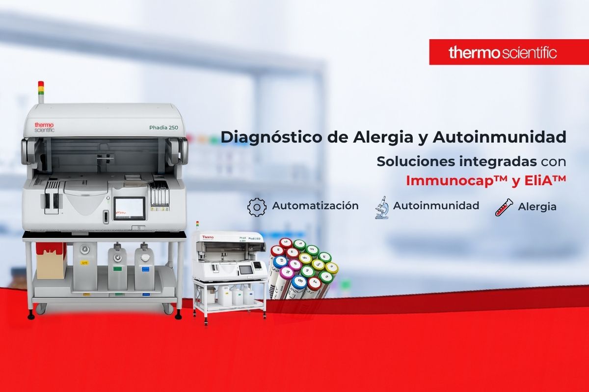Diagnóstico de Alergia y autoinmunidad